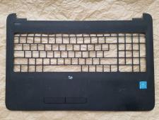 Верхня частина Hp&nbsp;15-AY037UR